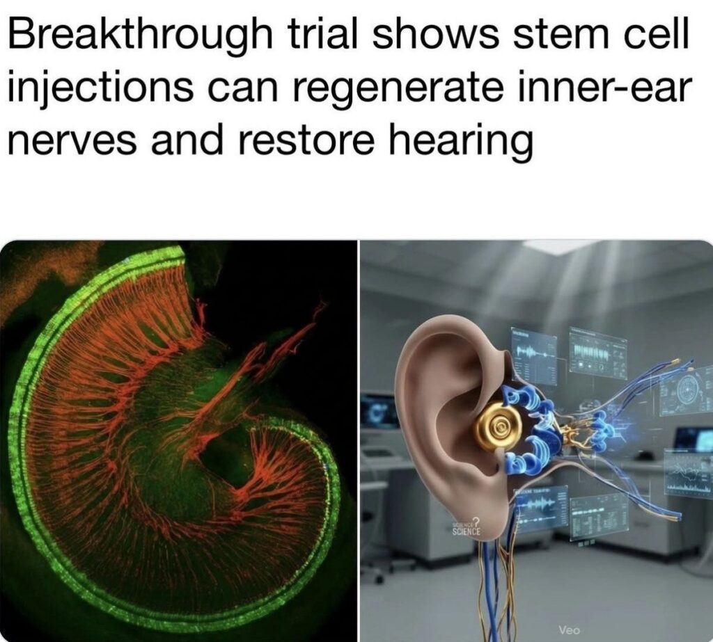 Stem Cell Hearing Loss “Breakthroughs”: But is it really?